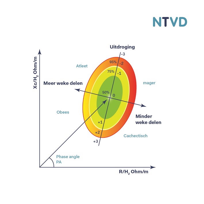 Afbeelding Bio-elektrische impedantie vectoranalyse (BIVA)