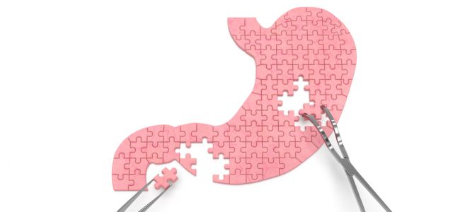 Afbeelding Jongen met eosinofiele oesofagitis