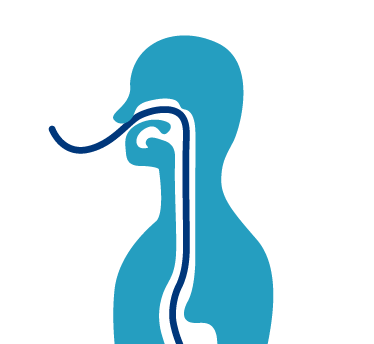 Afbeelding Ondervoeding door acute appendicitis