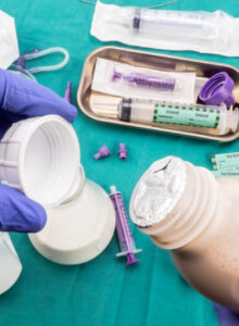 Afbeelding voor ‘Helaas nog zeer weinig onderzoek gedaan naar sondevoeding bij meest voorkomende aangeboren spierziekten’